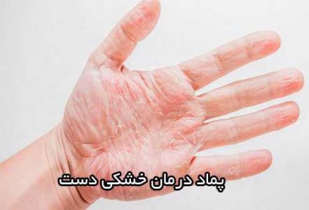 بهترین پماد برای خشکی پوست دست