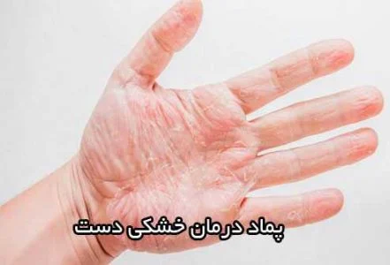 پوست بهترین پماد برای خشکی پوست دست