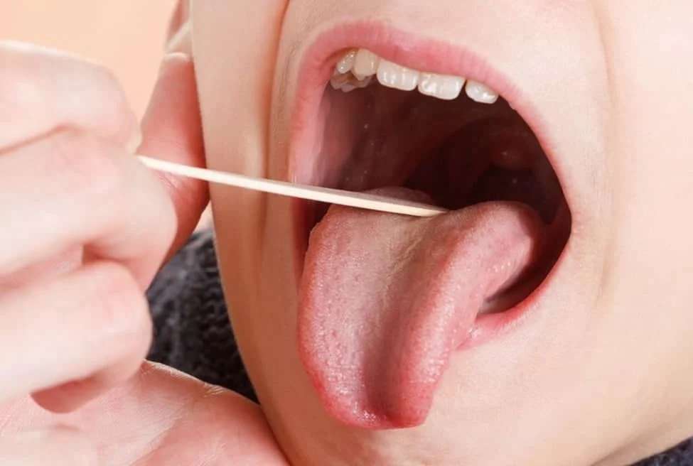 سرطان دهان و هر آنچه درباره آن باید بدانید