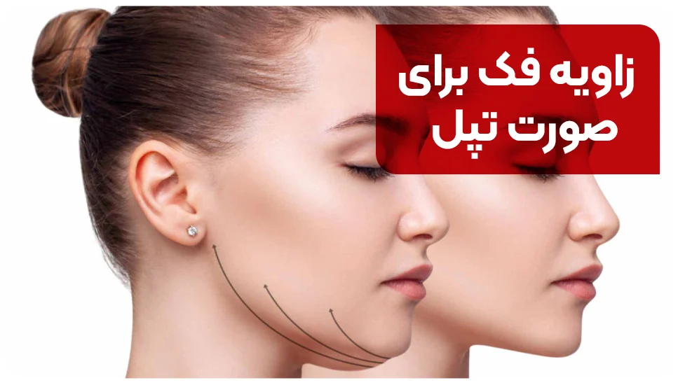 زاویه فک برای صورت تپل