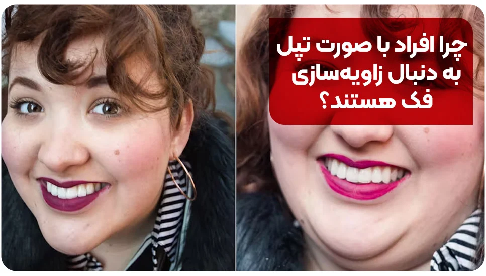 جراحی زیبایی | پوست چرا افراد با صورت تپل به دنبال زاویهسازی فک هستند؟