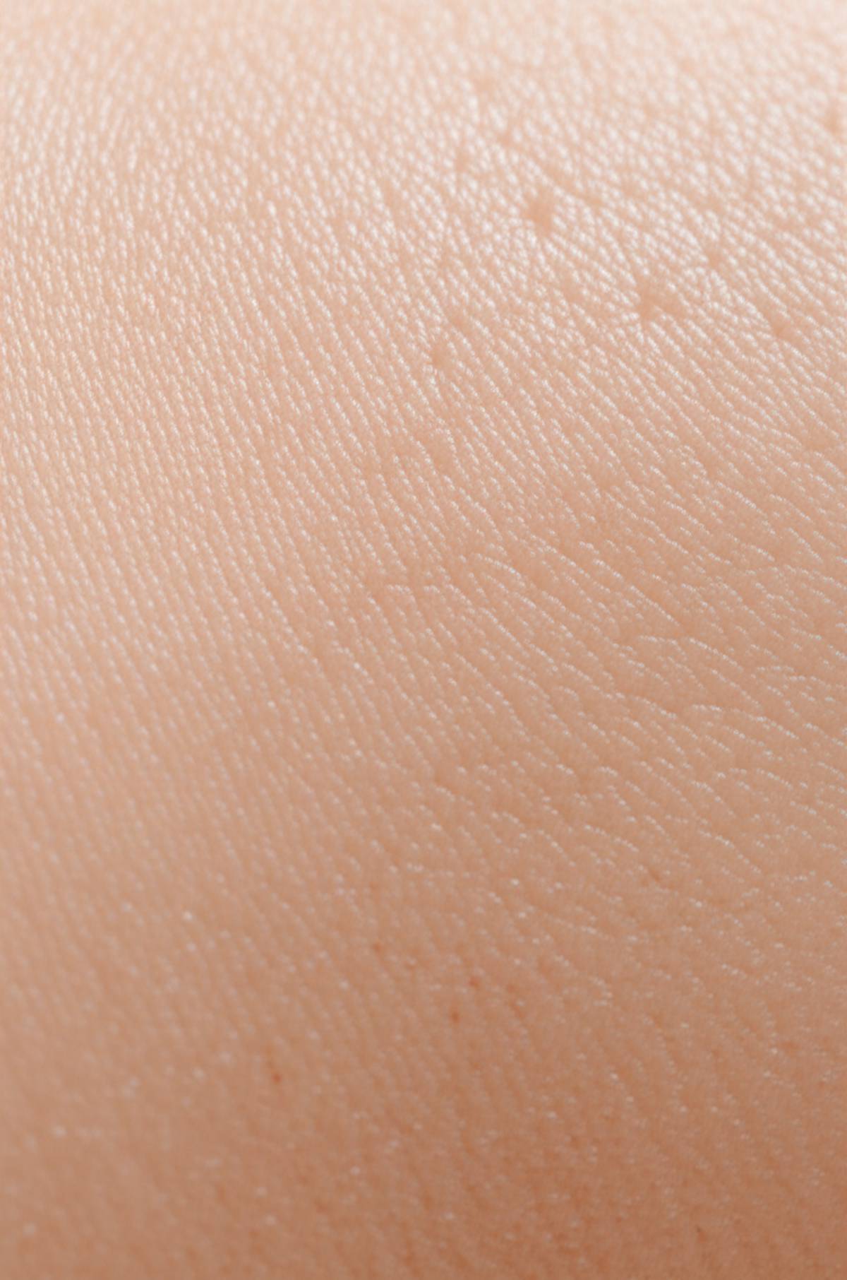 نقد و بررسی پماد زخم بستر قروح نیودرم | دارو درمان سلفچگان