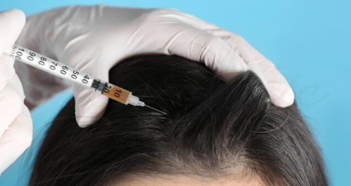تفاوت هیر فیلر و مزوتراپی؛ کدام روش برای موهای شما بهتر است؟