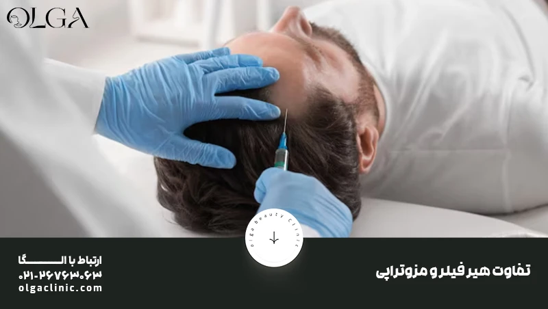 ریزش مو | مزوتراپی تفاوت هیر فیلر و مزوتراپی