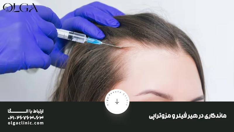 ریزش مو | مزوتراپی ماندگاری در هیر فیلر و مزوتراپی